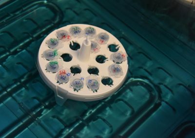 DNA der Verdächtigen